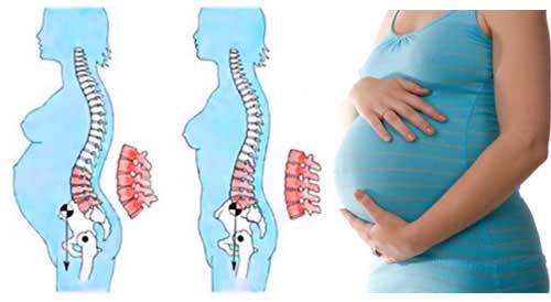 Lower Back Pain An Early Pregnancy Symptom PregnancyWalls